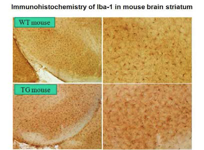 Immunohistochemistrical results in a LRRK hG2019S transgenic mouse