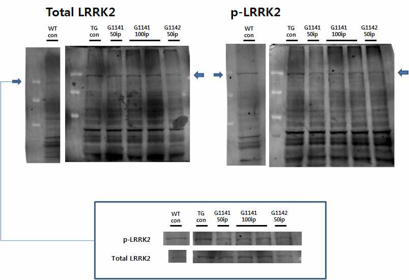 대조군 및 LRRK2 transgenic mouse군에 G-1141과 G-1142 복강내 투여에 의한 선조체에서의 total LRRK2 와 phosphorylated LRRK2 활성도의 변화