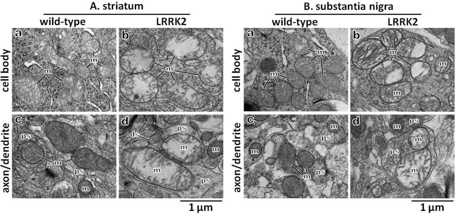 Target subcellular organelle: Mitochondria EM 사진