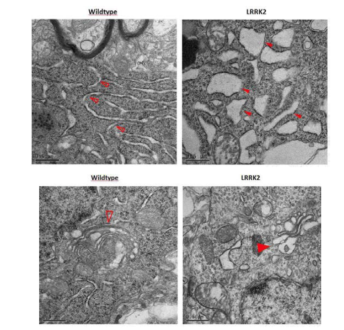 Target subcellular organelle: Golgi EM 사진