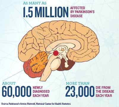 파킨슨병의 발병