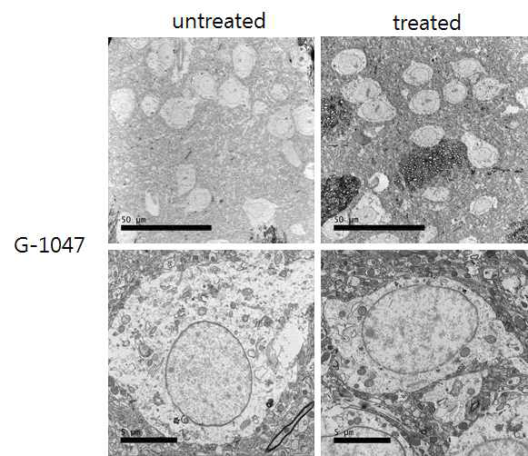 G-1047 10 mg/kg을 19일간 복강 내 주사한 hLRRK2 유전자 변이 마우스(4-6 개월)의 선조체 신경세포