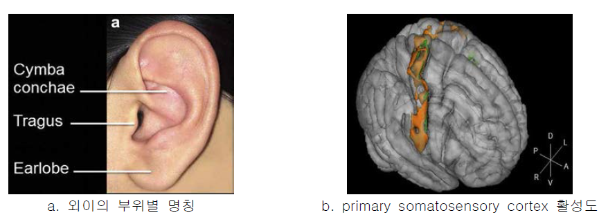 Cymba concha(황색)와 Earlobe(녹색)의 tVNS 효과