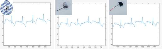 테스트 보드 및 전극의 ECG 확인