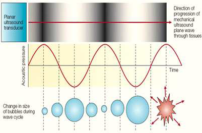 Mechanism of ultrasonic cavitation