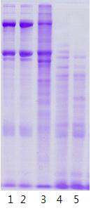 SDS-PAGE patterns of collagen and gelatin during pepsin digestion at 10℃