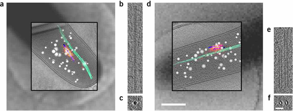 Cryo-PALM 이미지와 타겟물질의 Cryo-electron tomography 분석