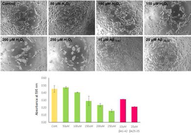 Ensure cell viability by beta-amyloid treatment