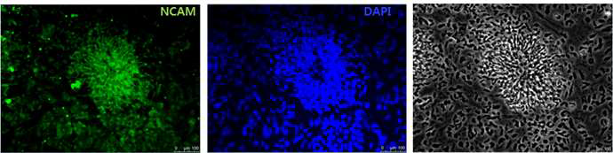 NCAM expression in Rosette