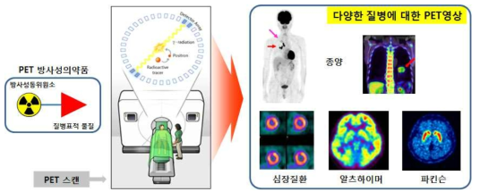 방사성의약품을 이용한 질병 진단