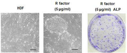R factor로 fibroblast를 역분화줄기세포로 유도함