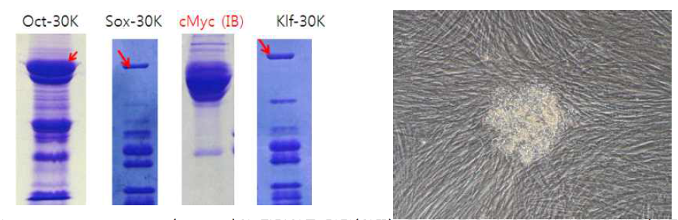 recombinant protein (4 factor)의 전기영동 결과(왼쪽), 그 단백질을 이용한 역분화줄기세포(오른쪽)