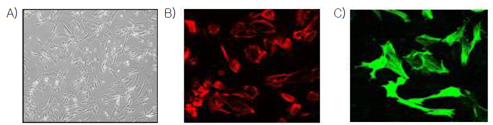 역분화 줄기세포의 혈관 평활근 세포로의 분화