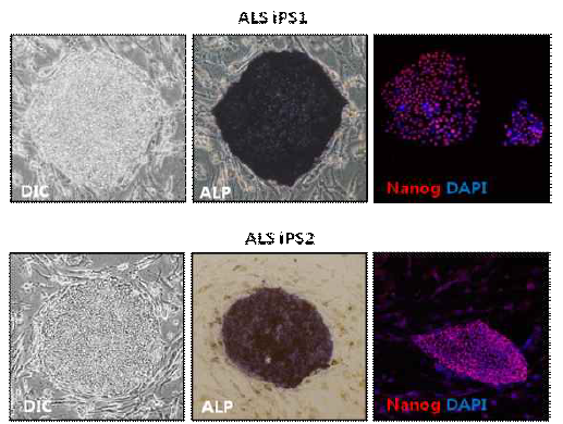 다른 두 명의 ALS 환자의 세포를 유도만능줄기세포로 확립하고 줄기세포성을 확인하기 위하여 ALP staining, Immunofluorescent staining을 수행함