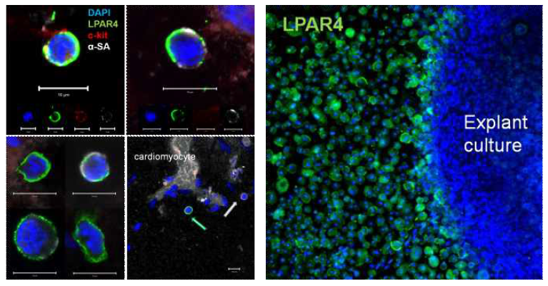 심장 내에 존재하는 성체줄기세포와(좌) 조직 배양을 통해 고효율로 대량 추출된 LPAR4 양성 세포 (우)