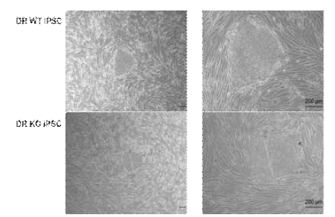 HLA-DR이 KO된 세포를 이용한 역분화 줄기세포 제작