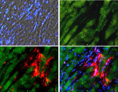 심근에 대한 골격근모세포의 생착능, DAPI(blue), Conneixn43(Green), Dil-SMB(Res)
