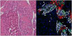 EPC-coated islet grafts in the liver