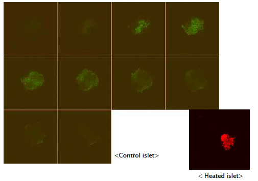 Confocal Microscopy: AO-PI dual channel (human islet)