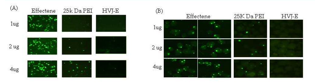 PEI25k, HVJ-E, Effectene / pEGFP-C1 were transfected into INS-1 (A) & rat islets (B)