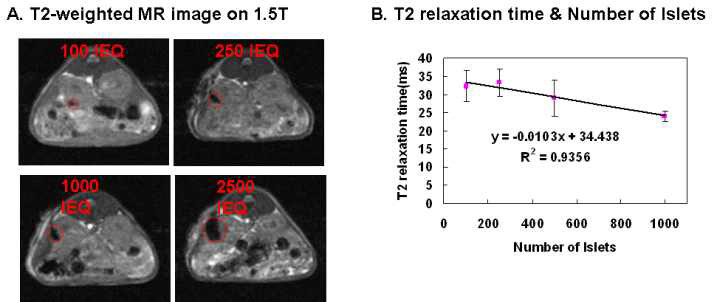 이식 췌도 숫자와 MR신호 상관관계 (a) T2-weighted MR영상 (b) 이식 췌도 수와 T2 relaxation time (ms) 의 상관관계 수식그래프