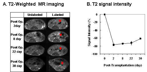 나노입자 표지 췌도의 신장 피막 이식 모델에서 실시간 MR영상(a) 과 신호강도(Signal intensity) 측정 그래프 (b)