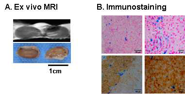(a) Ex vivo MR영상과 (b) 인슐린 면역 염색과 Prussian 염색