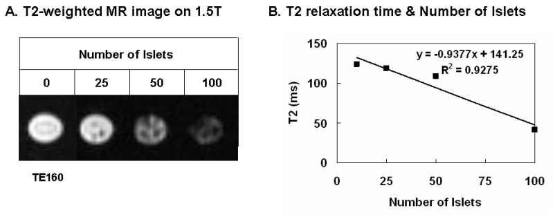 췌도수와 MR신호 상관관계 (a) T2-weighted MR 영상 (b) 표지 췌도수와 T2 relaxation time (ms) 의 상관관계 수식그래프