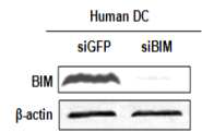 siBIM 형질주입에 의한 인간 수지상세포 내 BIM 발현 감소