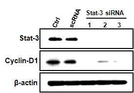 AGS 세포주에 stat3 siRNA 처리 후 stat3 및 cyclin D1의 발현 감소