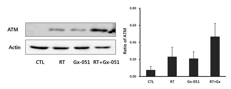ATM was more respectively expressed by GX-051 with RT combied therapy in the AT-84 allografted C3H/HeN mice
