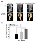 PCL/PLGA scaffold의 X-ray 및 CT analysis