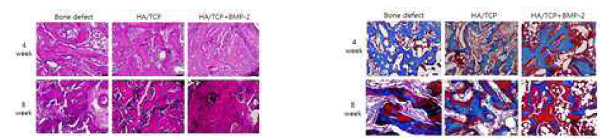 골이식재 삽입 후 4, 8 주 후 조직염색 사진(H&E 와 TRI)