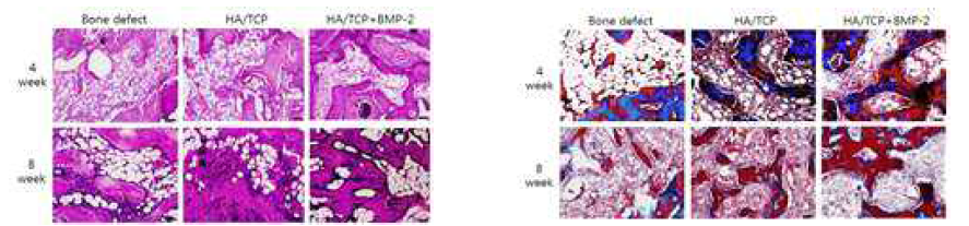 골이식재 삽입 후 4, 8 주 후 조직염색 사진(H&E 와 TRI)