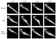 골이식재 및 BMP-2 이식 후 2, 4, 6, 8주 후 X-ray 촬영 사진