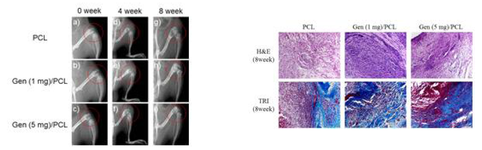 인공지지체 삽입 후 4, 8 주 후 X-ray와 조직염색 사진