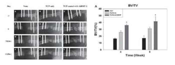 TCP-HA와 BMP-2/TCP-HA를 투여한 후 4주와 8주 후에 찍은 X-ray 영상과 각 그룹별 골 볼륨과 조직 볼륨 비율