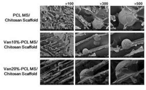 항생제 vancomycin을 함유하는 미립구를 포함하는 키토산 스캐폴드의 표면 SEM 사진