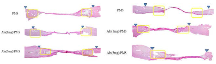 PMSs 주입 후 4, 8 주 후 조직염색 사진(H&E)