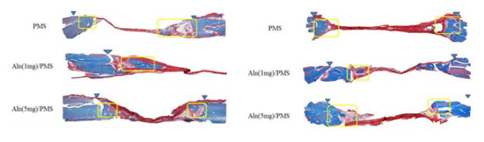 PMSs 주입 후 4, 8 주 후 조직염색 사진(TRI)