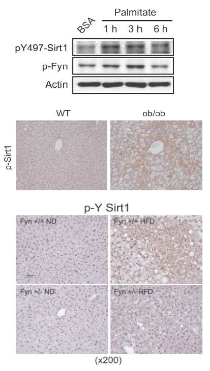 vitro 및 in vivo 실험 모델계를 활용한 Sirt1 인산화의 검증