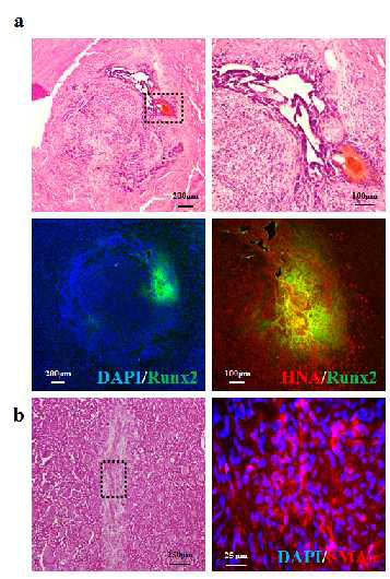 PSA-NCAM 음성세포가 유발하는 중배엽 기원의 종양형성
