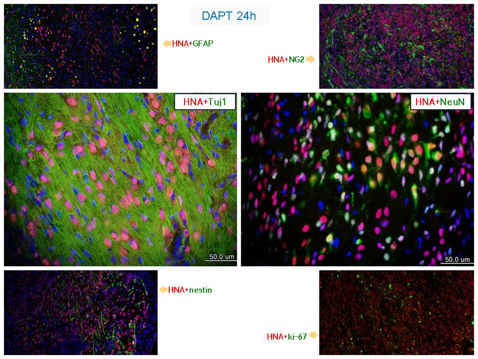 척수손상 동물모델에 DAPT를 24시간 처리한 세포를 이식하고 10주 후에 세포 분화 양상