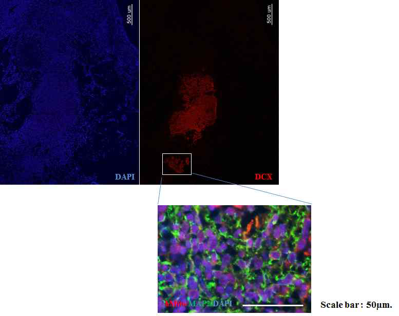 PSA-NCAM 양성 신경전구세포를 이식한 흰 쥐 조직에서 이식세포 (hMito-양성세포)가 MAP2를 발현