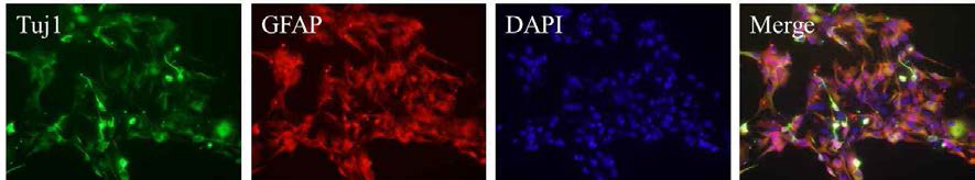 면역조직화학염색로 신경세포의 마커인 Tuj1, 신경교세포의 마커인 GFAP가 발현하는 것을 확인