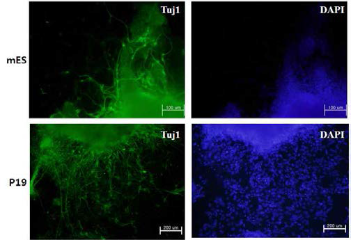 마우스 줄기세포 및 P19 세포의 신경세포 분화 유도 후 면역학적 염색을 통한 신경세포 분석