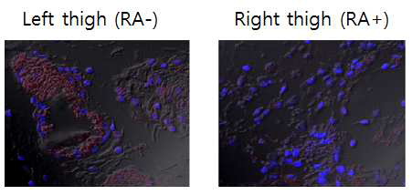 마우스 내 주입한 P19 세포의 신경분화 유도 여부에 대한 MF targeting TfR의 세포 내 이입량 차이 비교