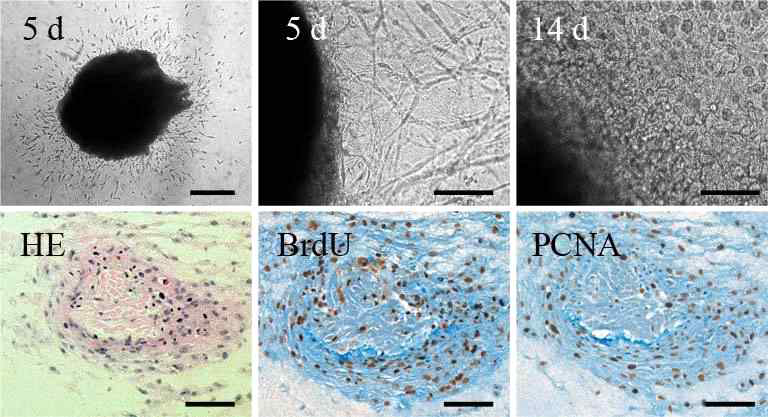 Microscopic photographs of outgrowing cells into hydrogel from myocardium during in vitro 3-dimensional organ culture of myocardium