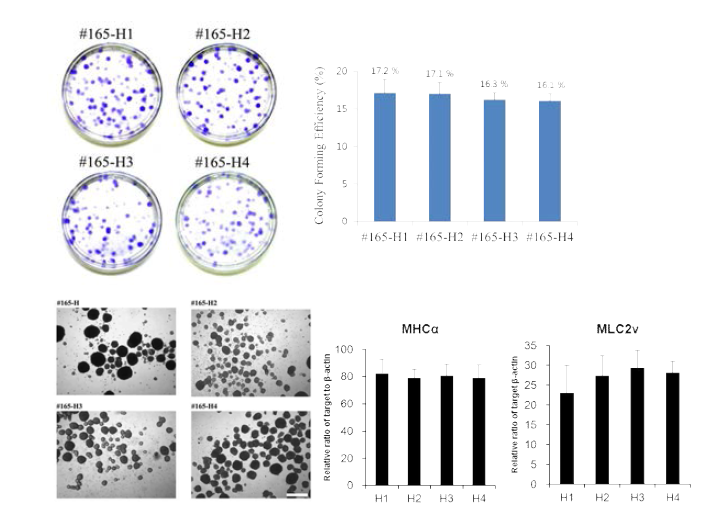 The in vitro growth potential and cardiomyogenic differentiation potential of cardiac stem cells isolated by repetitious organ cultures of myocardium