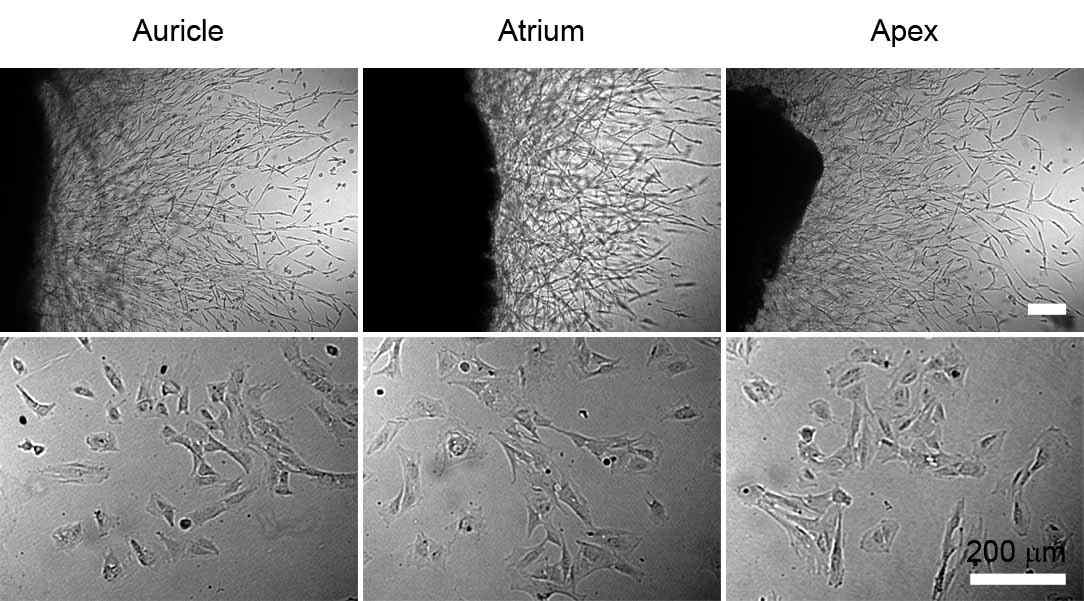 Representative photographs of outgrown cells from the minipig hearts in 3-dimensional (upper) and monolayer (lower) culture condition